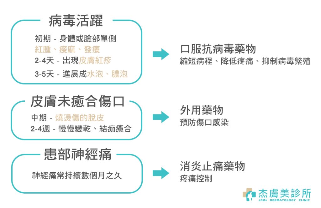 帶狀皰疹(皮蛇)病程/治療 | 杰膚美診所